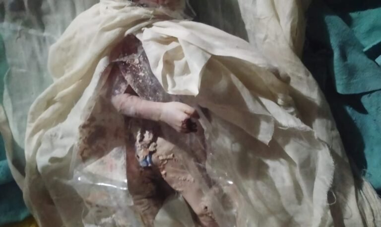 कुछ तो शर्म कर लो धरती के भगवानों, अस्पताल में चूहे की जिम्मेदारी किसकी, क्यों डीन और अधीक्षक पर अब तक नहीं हुई कार्रवाई?