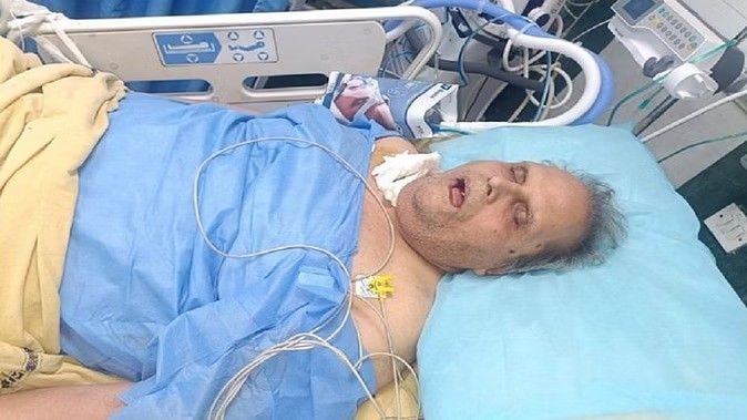 इधर, जम्मू-कश्मीर के पूर्व राज्यपाल सतपाल मलिक के खिलाफ सीबीआई ने दाखिल की चार्जशीट, उधर, अस्पताल में भर्ती दिखे मलिक