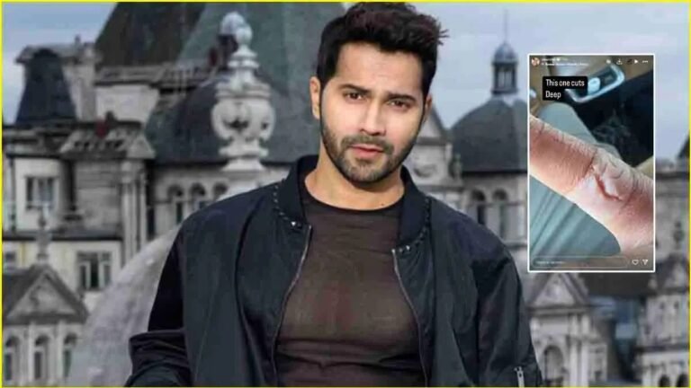 बॉर्डर 2' की शूटिंग के दौरान घायल हुए वरुण धवन, शेयर की चोट की तस्वीर