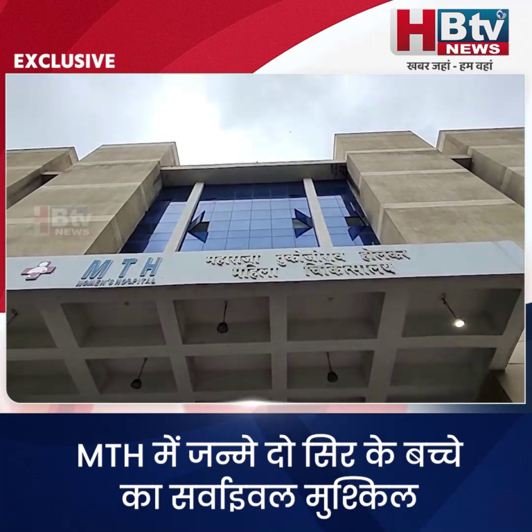 INDORE..MTH में जन्मे दो सिर के बच्चे का सर्वाइवल मुश्किल....