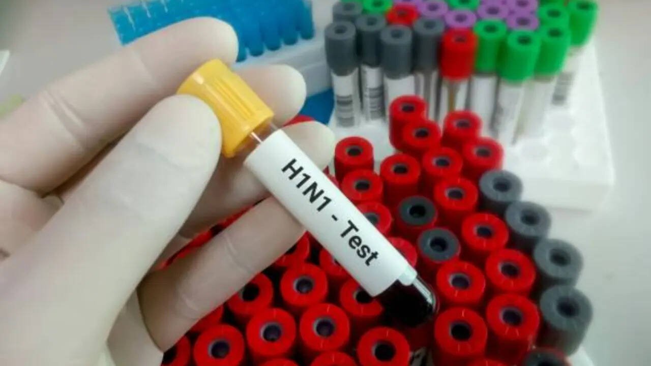 इंदौर में H1N1 का दूसरा केस, स्वास्थ्य विभाग ने जारी की एडवाइजरी 2 स्वाइन फ्लू H1N1 संक्रमण इंदौर